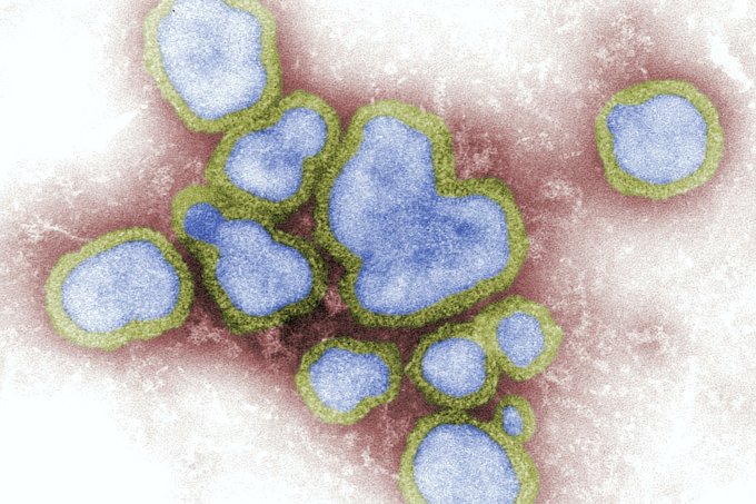 Gripe H3N2: como evitar, quais os sintomas e a eficácia da vacina